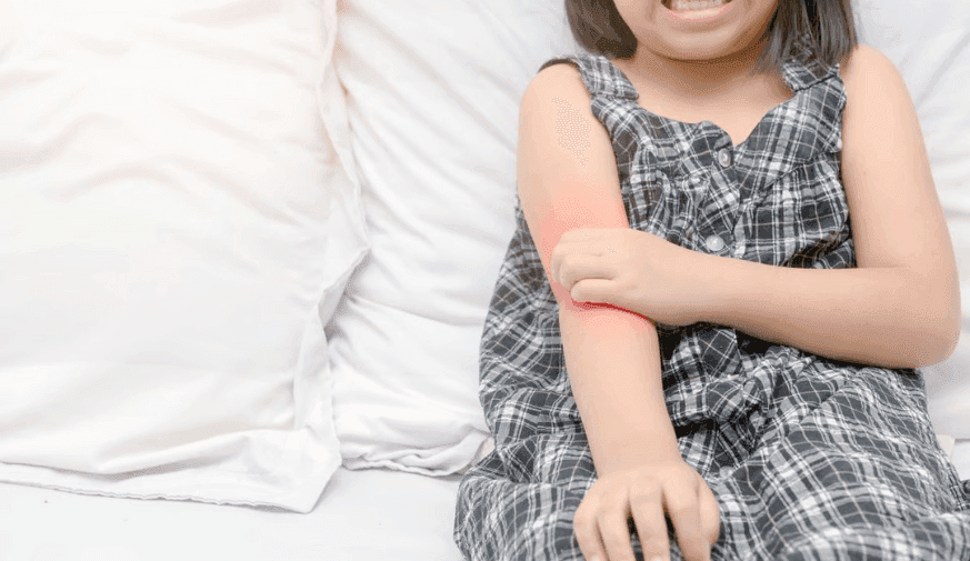 Link Between n-3 LCPUFA, Eczema Varies by Maternal COX1 Genotype