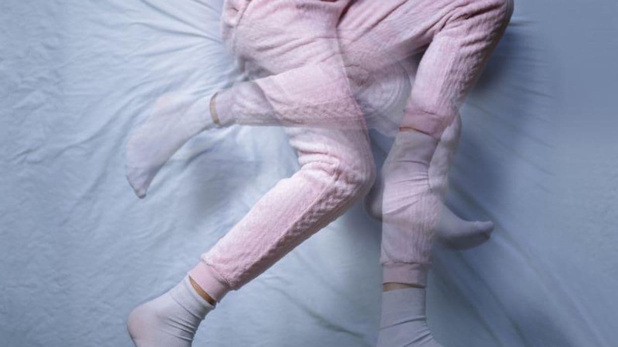 Restless Leg Syndrome More Common in Psoriasis Patients