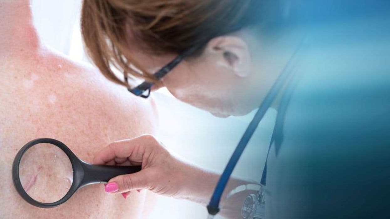 Treatment Needs Often Unmet for Generalized Pustular Psoriasis